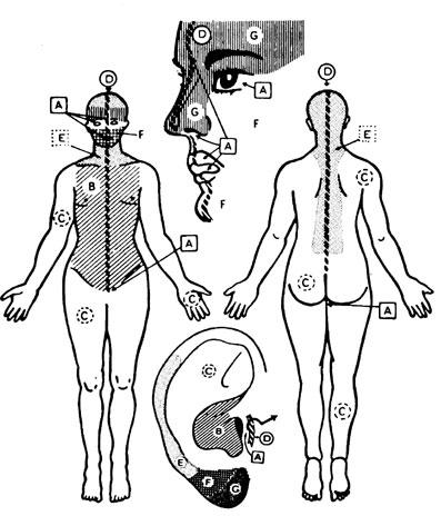 Frequency zones (Nogier) Nogier zones, acupuncture with Nogier frequencies, RAC, laser therapy