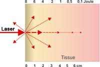 Rayo láser en el tejido